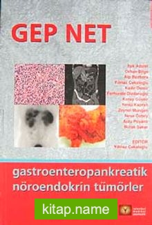 Gep Net Gastroenteropankreatik Nöroendokrin Tümörler