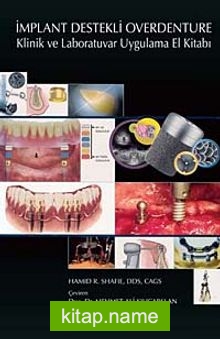 İmplant Destekli Overdenture Klinik ve Laboratuvar Uygulama El Kitabı