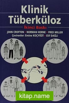 Klinik Tüberküloz