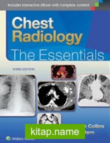 Chest Radiology