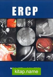 ERCP