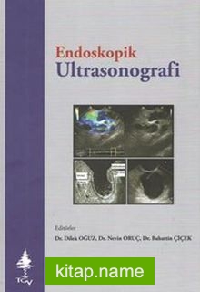 Endoskopik Ultrasonografi