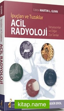 İpuçları ve Tuzaklar Acil Radyoloji Varyasyonlar ve Diğer Zor Tanılar