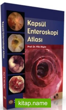 Kapsül Enteroskopi Atlası (Ciltli)