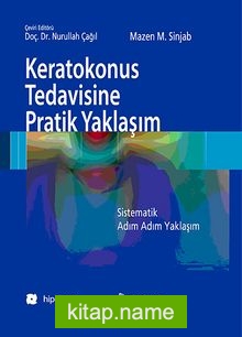 Keratokonus Tedavisine Pratik Yaklaşım