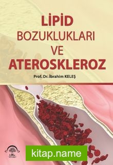 Lipid Bozuklukları ve Ateroskleroz