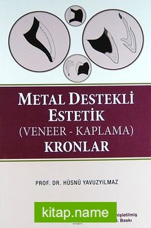 Metal Destekli Estetik (Veneer-Kaplama) Kronlar