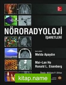 Nöroradyoloji İşaretleri