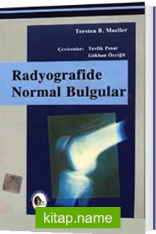 Radyografide Normal Bulgular