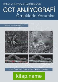 Retina ve Koroidea Hastalıklarında OCT Anjiyografi  Örneklerle Yorumlar