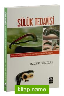 Sülük Tedavisi  Ruhsal ve Fiziksel Hastalıklarda Geleneksel Tedavi